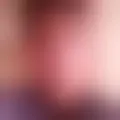 Chat med  ----132760